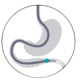 ERCP Test Mumbai.